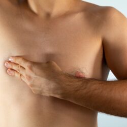 Gynaecomastia in Paris — Plastic surgery for men, Rive Droite Paris Étoile practice