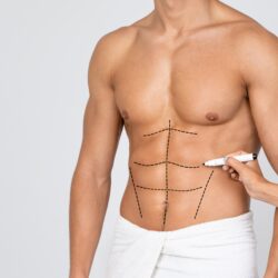 Abdominal etching in Paris — Plastic surgery for men, Rive Droite Paris Étoile practice