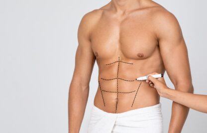 Plastic surgery for men