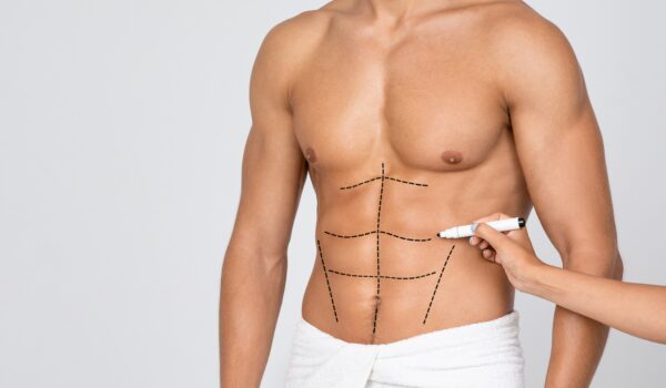 Plastic surgery for men in Paris — gynaecomastia and abdominal etching
