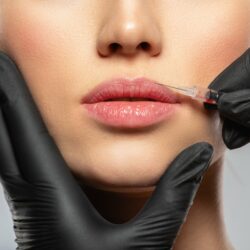 Injection d'acide hyaluronique