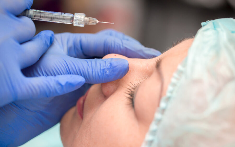Injection d'acide hyaluronique à effet volumateur