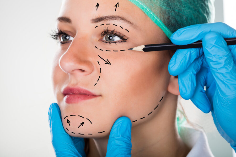 Intervention de lifting du visage par repositionnement des tissus