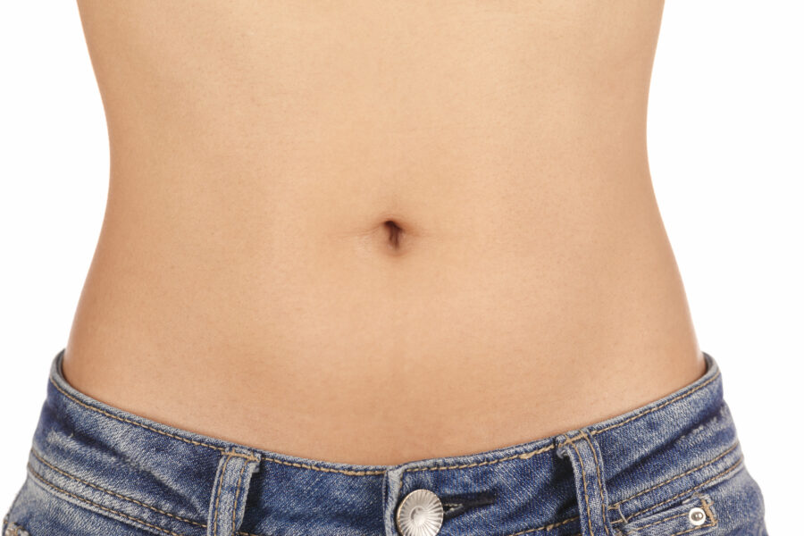 Relachement cutané de l'abdomen