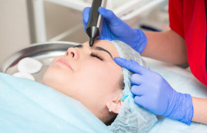 Dermatological surgery