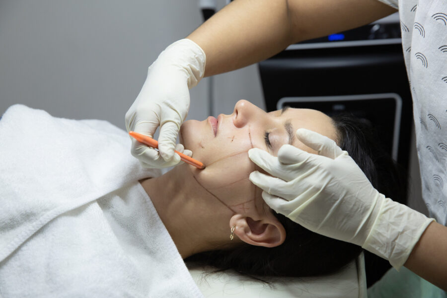 Lifting cervico facial