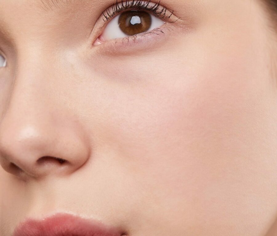 Résultat rhinoplastie de la pointe du nez