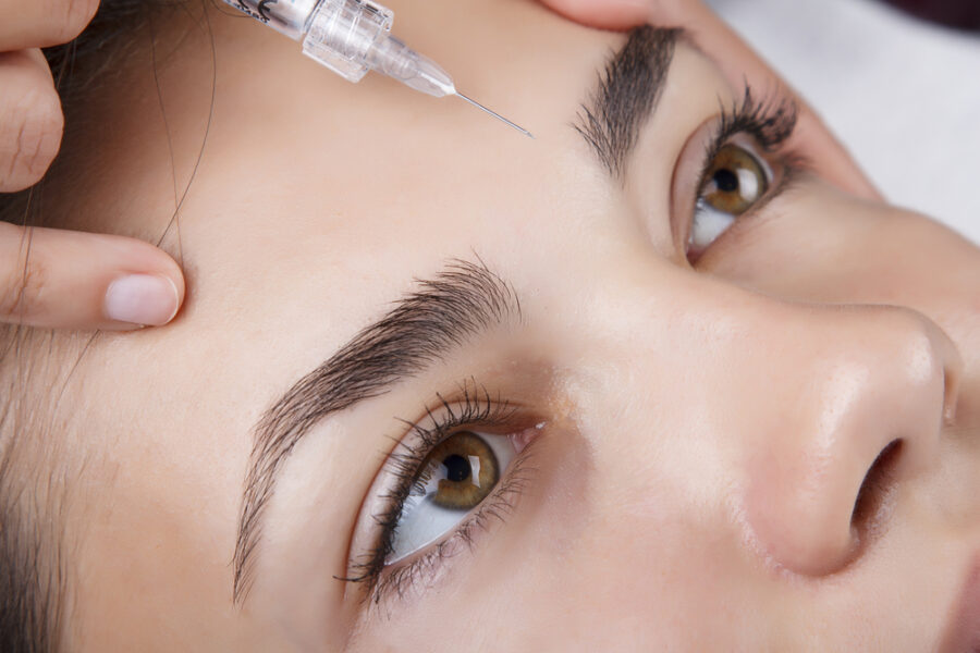 Injection d'acide hyaluronique au niveau des sourcils