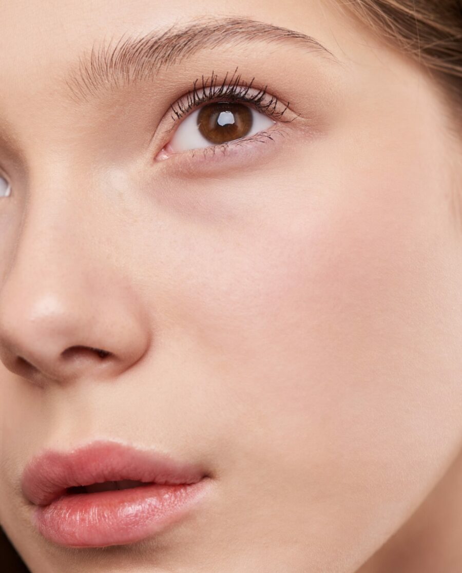 Résultats radiofréquence fractionnée avec microneedling
