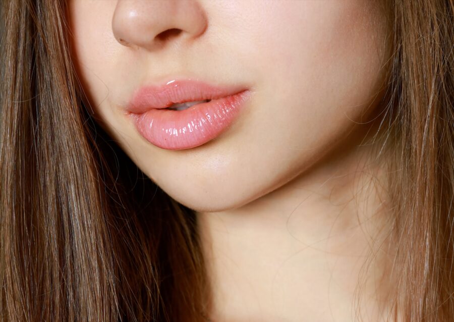 Radiofréquence fractionnée avec Microneedling