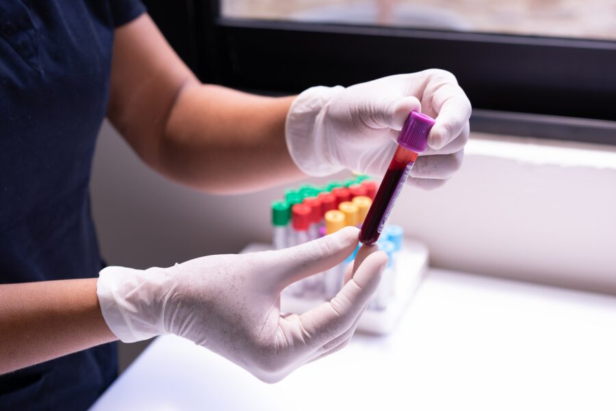 Injection de plasma enrichi en plaquettes
