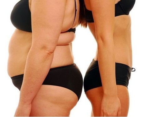 les résultats avant après l'opération de liposuccion peuvent être stupéfiants