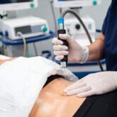 Radiofréquence fractionnée Quantum RF pour lifting sans cicatrice