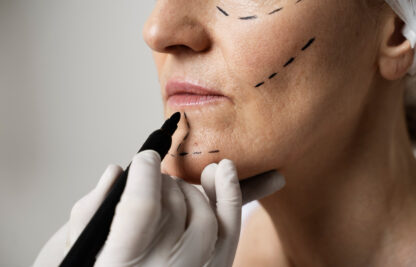 Facial feminization surgery: understanding FFS procedures — Rive Droite Paris Étoile clinic journal