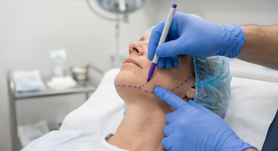 facelift with absorbable thread lift in Paris 17