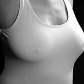 Augmentation mammaire avec implant en dual plan