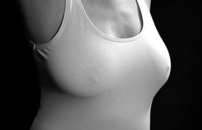 Augmentation mammaire avec implant en dual plan
